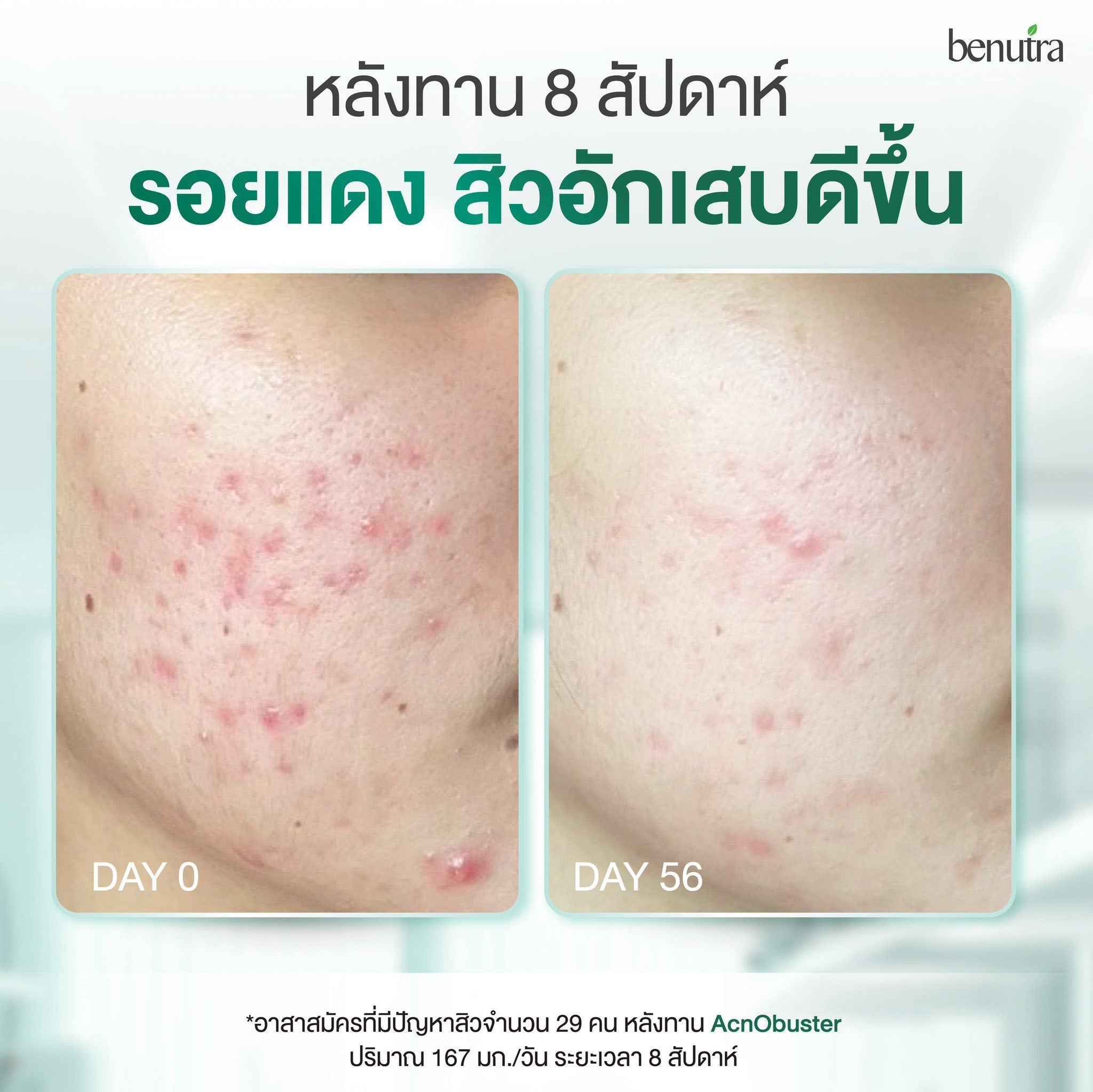 BENUTRA TETRA SOD with Astaxanthin CoQ10 Antioxidant Power for Skin Health