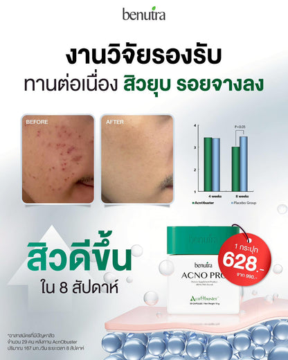 BENUTRA TETRA SOD with Astaxanthin CoQ10 Antioxidant Power for Skin Health