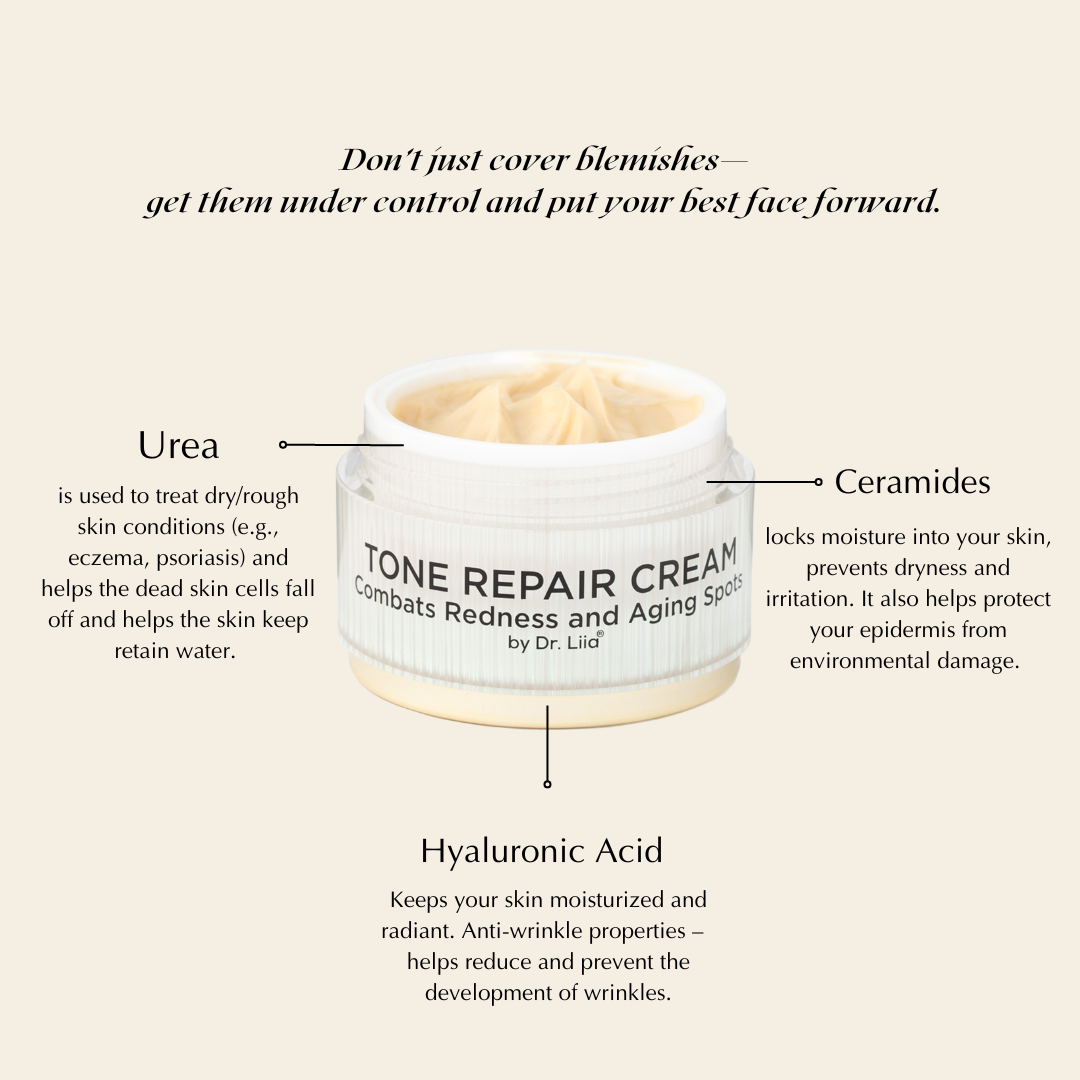 Brightening Tone Repair Cream for Dark Spots &amp; Uneven Skin – Vegan &amp; Gluten-Free by EpiLynx