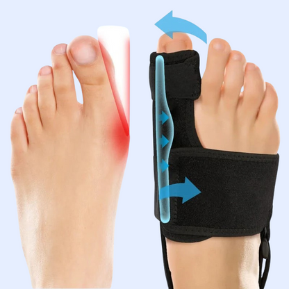 BunioAlign™ Bunion Corrector – Toe Alignment with Adjustable Support Straps