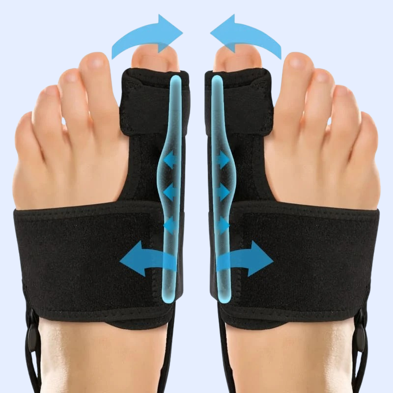 BunioAlign™ Bunion Corrector – Toe Alignment with Adjustable Support Straps