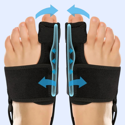 BunioAlign™ Bunion Corrector – Toe Alignment with Adjustable Support Straps