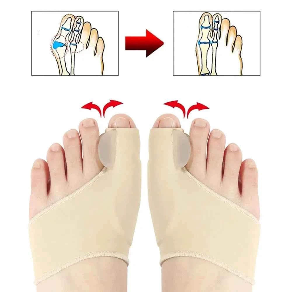BunEase™ Corrector Socks – Gentle Bunion Pain Relief &amp; Foot Support