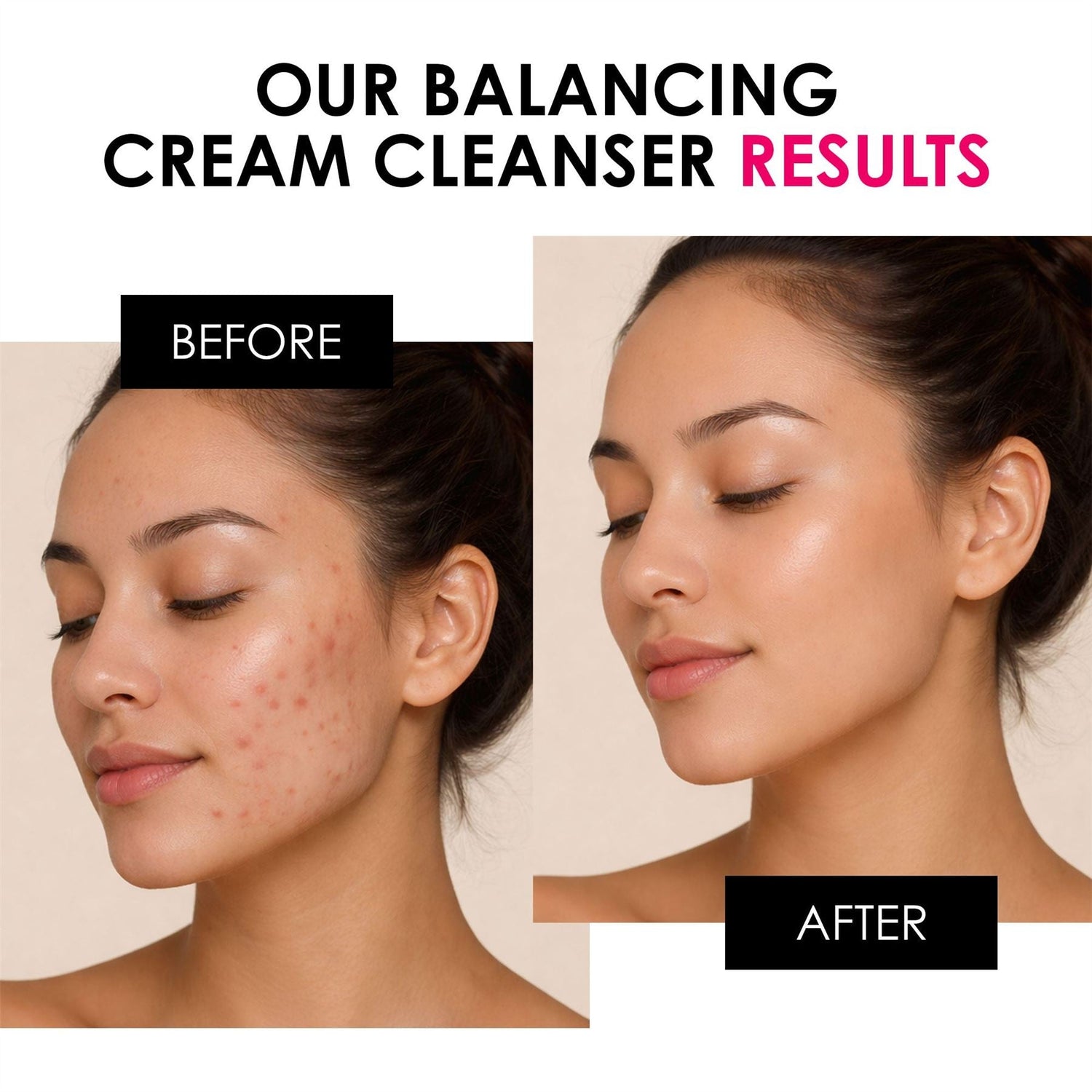 Balancing Vitamin C &amp; Glycolic Acid Cream Cleanser 200ml by skinChemists US