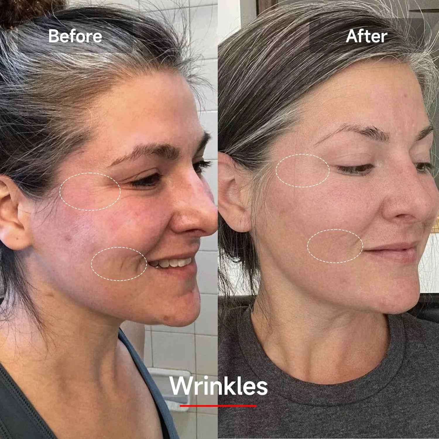 LED Red Light Therapy Mask