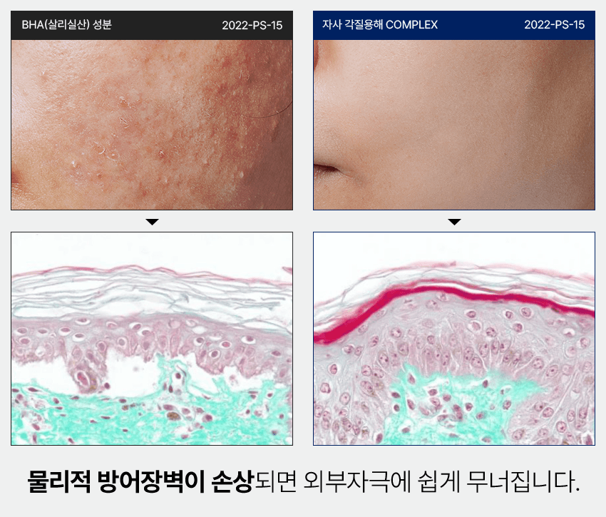 PERCENT SCIENCE Dexynol-16.3 Booster Skin Essence 4.7 Oz. - Acne/Trouble