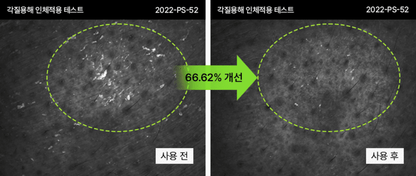 PERCENT SCIENCE Dexynol-16.3 Booster Skin Essence 4.7 Oz. - Acne/Trouble
