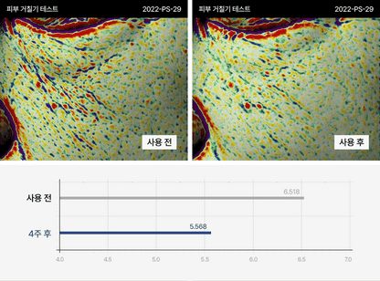PERCENT SCIENCE Dexynol-16.3 Cream 2 Oz. - Acne/Trouble