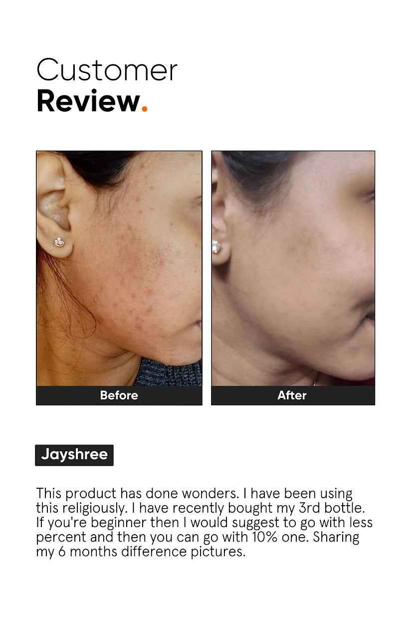 Minimalist 10% Niacinamide Face Serum