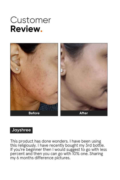 Minimalist 10% Niacinamide Face Serum