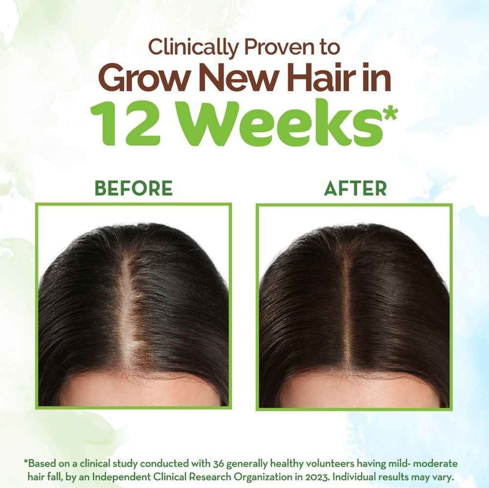 Mamaearth Rosemary Hair Growth Oil with Rosemary &amp; Methi Dana