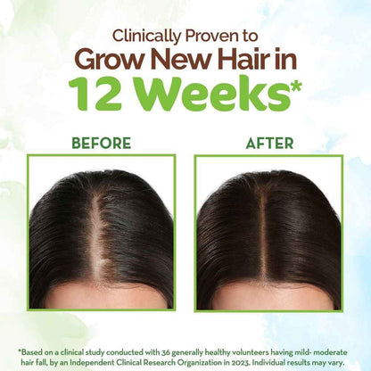 Mamaearth Rosemary Hair Growth Oil with Rosemary &amp; Methi Dana