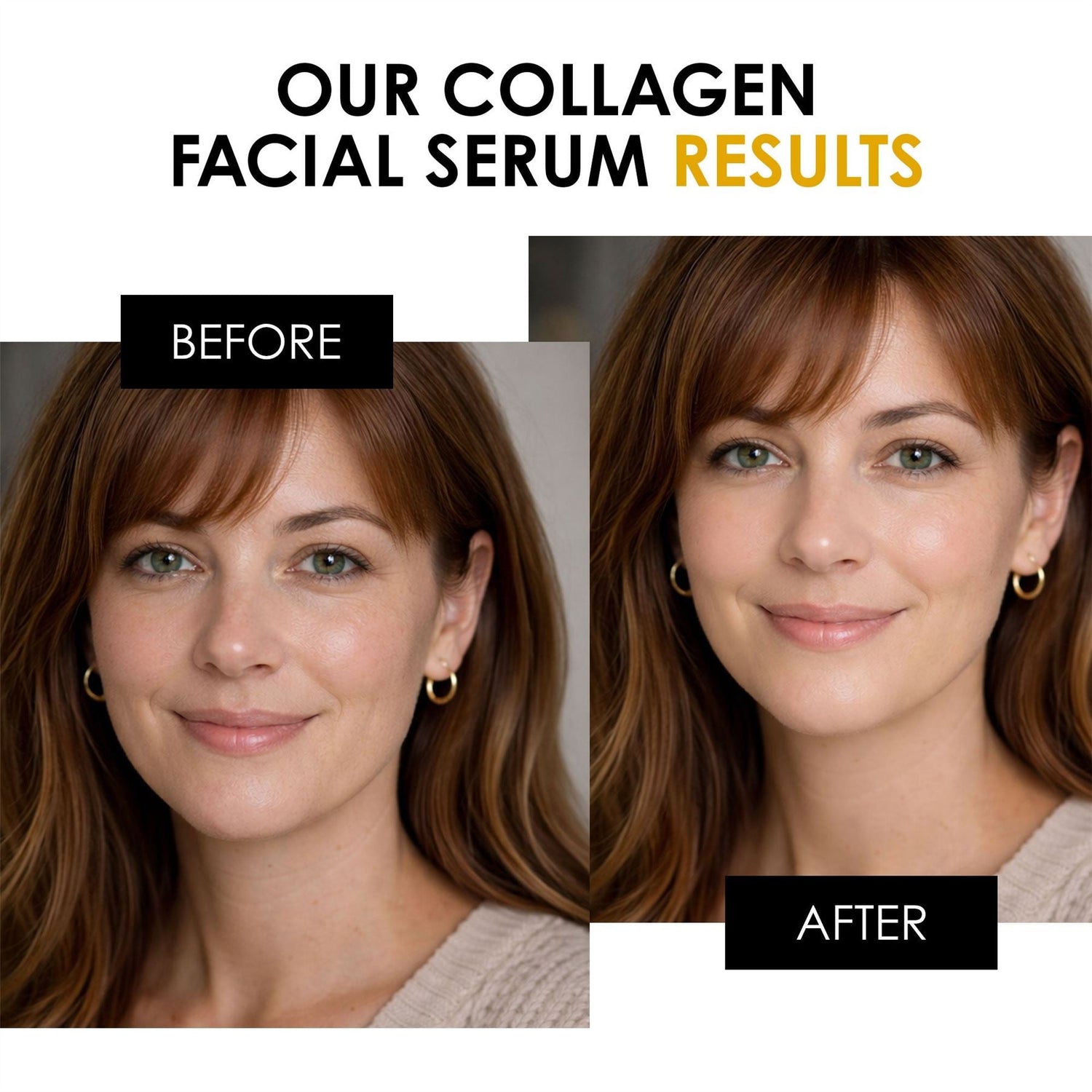 1% Collagen Night Moisturiser 50ml (Vegan) by skinChemists US