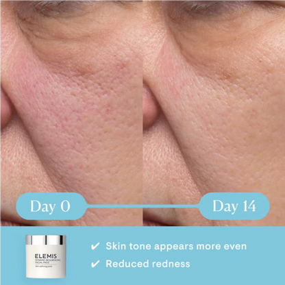Elemis Dynamic Resurfacing Facial Pads 60pk  DestGlow
