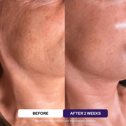 Elixir Serum - 24kGold Ceramides Niacinamide Vitamin C - DestGlow