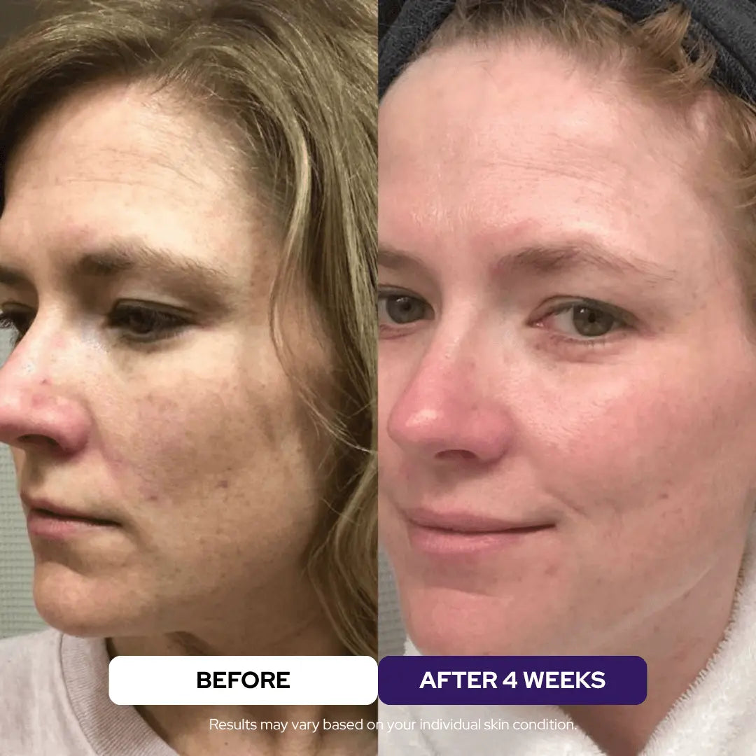 Elixir Serum - 24kGold Ceramides Niacinamide Vitamin C - DestGlow