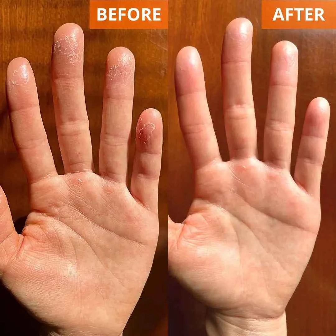 Moisturizing Skin Cream 4.4 Fl. Oz. Jar