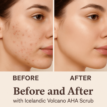 Icelandic Volcano AHA Face &amp; Body Scrub
