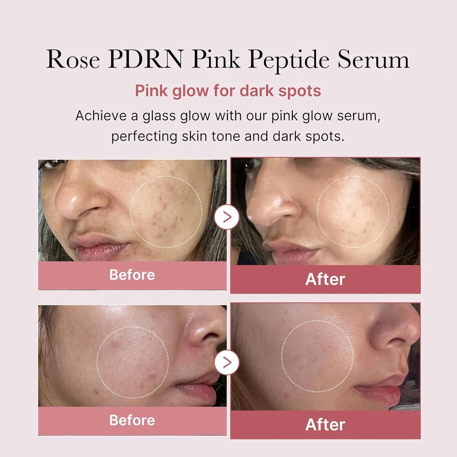 Plumping Serum - Peptides PDRN Niacinamide Retinol