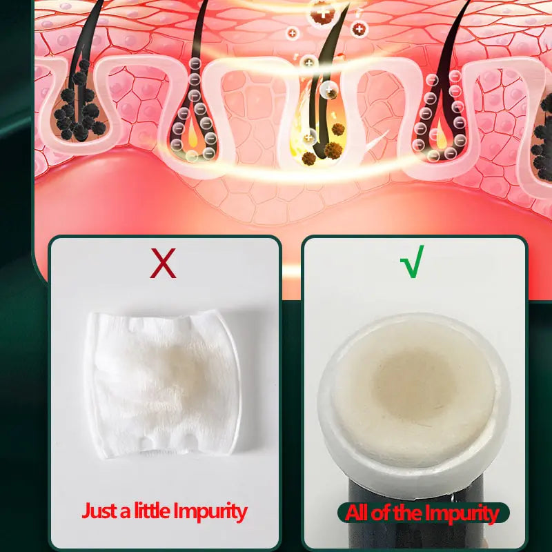 Ultrasonic Skin Scrubber - Deep Pore Cleansing & Exfoliation Device for Clear, Radiant Skin - DestGlow