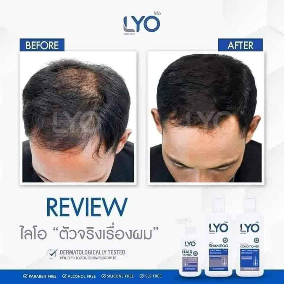 LYO Shampoo Conditioner Hair Tonic Treatment Hair Strengthen &amp; Regrowth