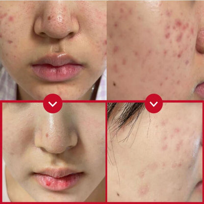 [VENDERMA] Red Calming Cica Exo Soothing Cream 50ml by Pi-Boo