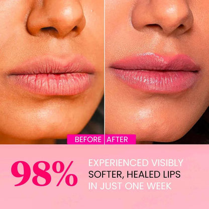 Plumping Lip Masks - Collagen, Hyaluronic Acid, Centella Asiatica