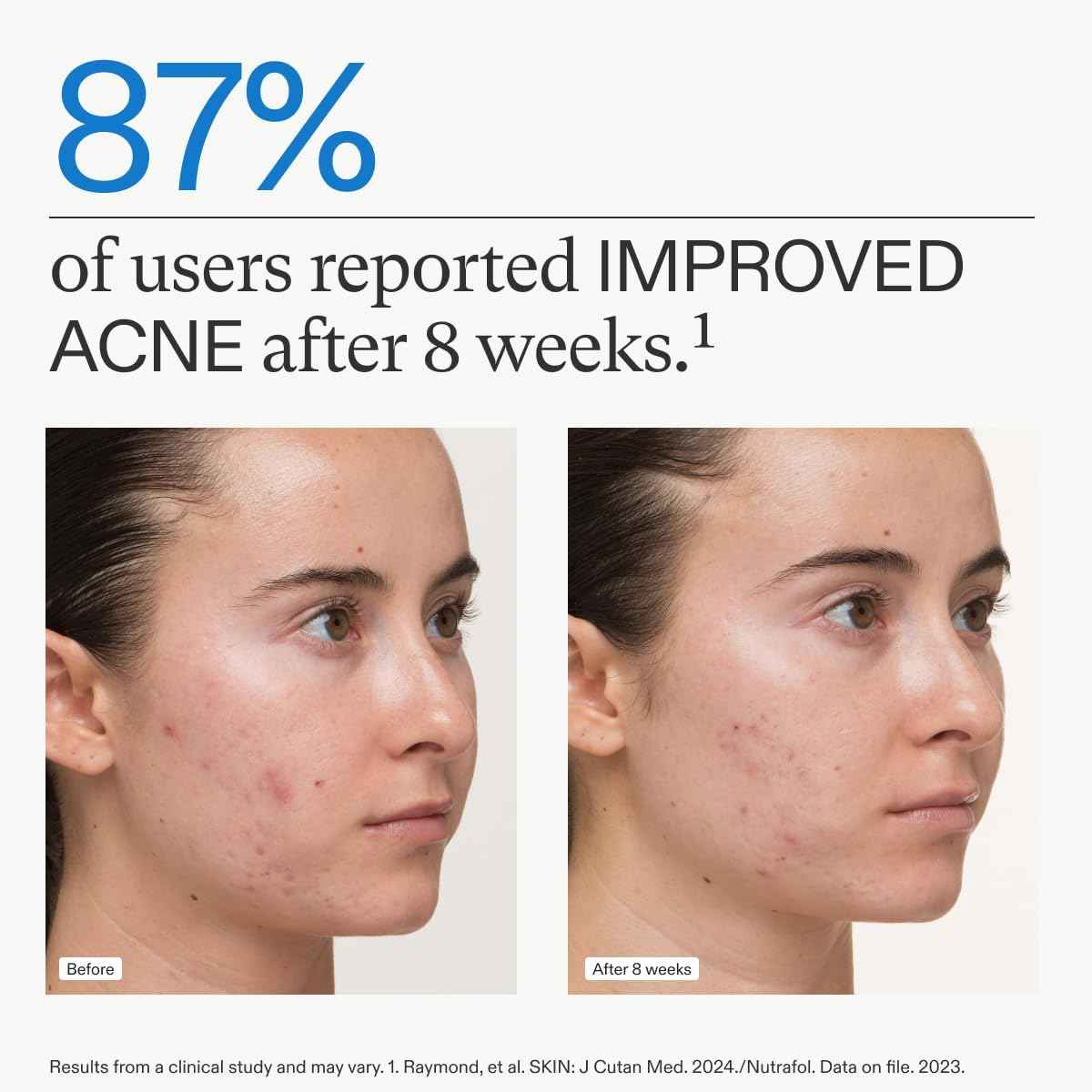 Nutrafol Clear Skin Nutraceutical Acne Supplement 3-Month Supply