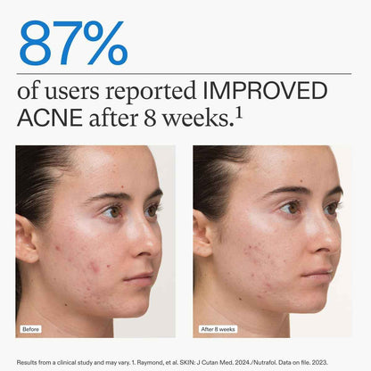 Nutrafol Clear Skin Nutraceutical Acne Supplement 3-Month Supply