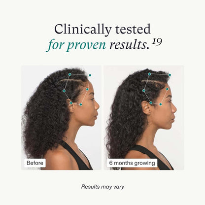 Nutrafol Women&