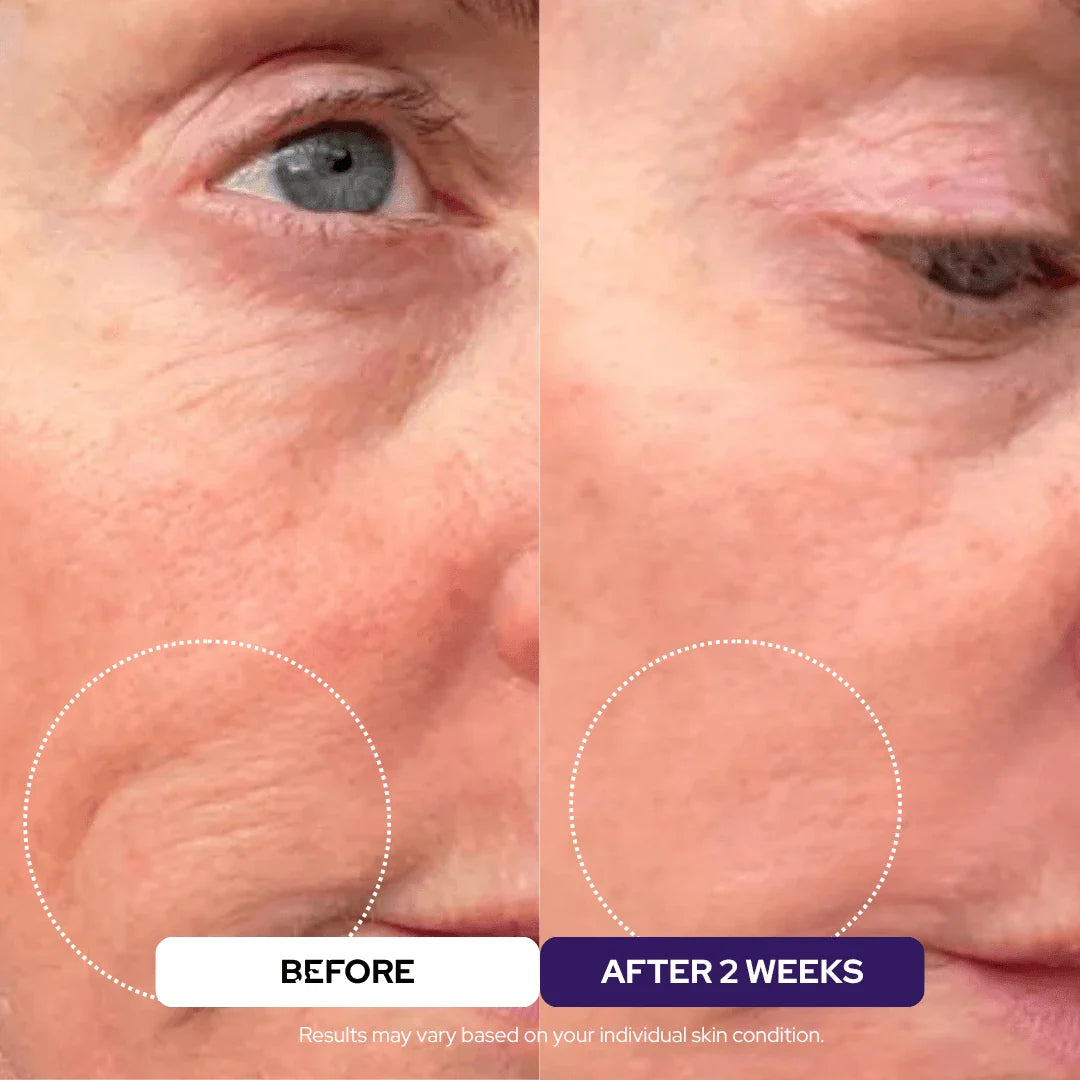 Plumping Serum - Peptides PDRN Niacinamide Retinol - DestGlow