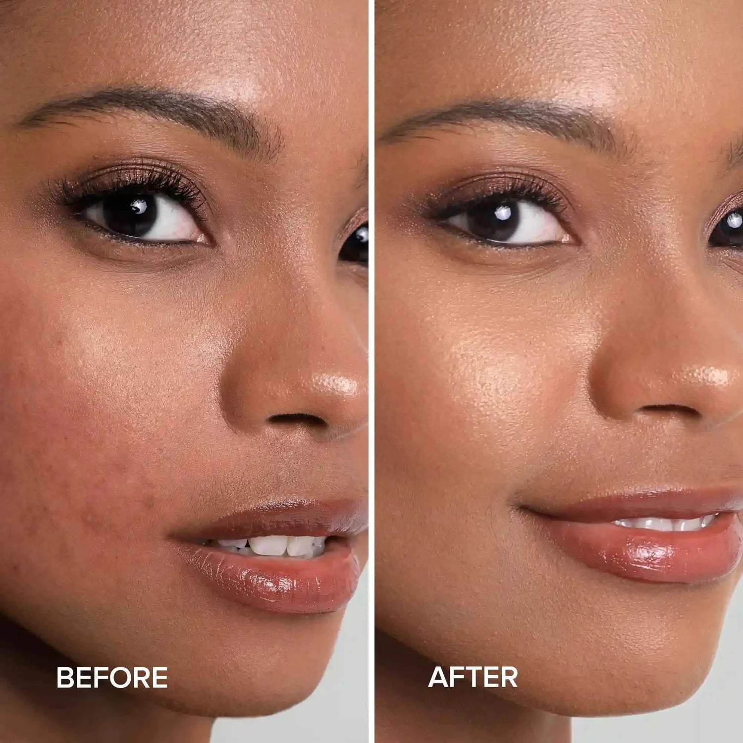 Turmeric Kojic Soap &amp; Scrub