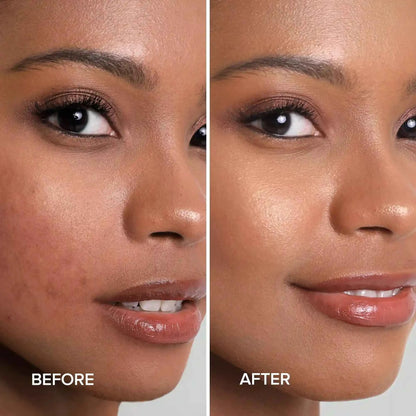 Turmeric Kojic Soap &amp; Scrub