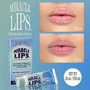 Miracle Lips Salve for Dry, Cracked, Sunburned Lips &amp; Cold Sores