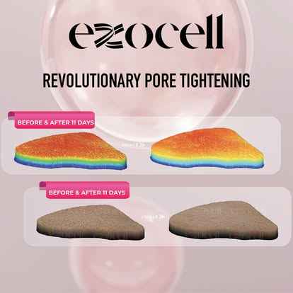 EXOCELL Exosome Rejuvenation Ampoule Stem Cell Power Bottle
