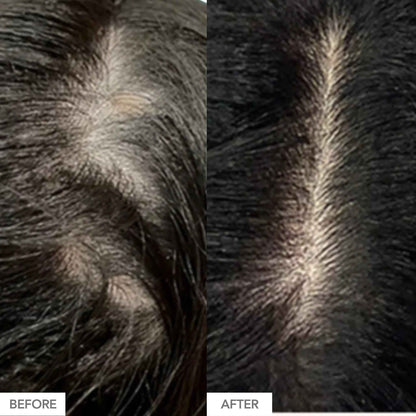 Gorgeous Growth Scalp Serum