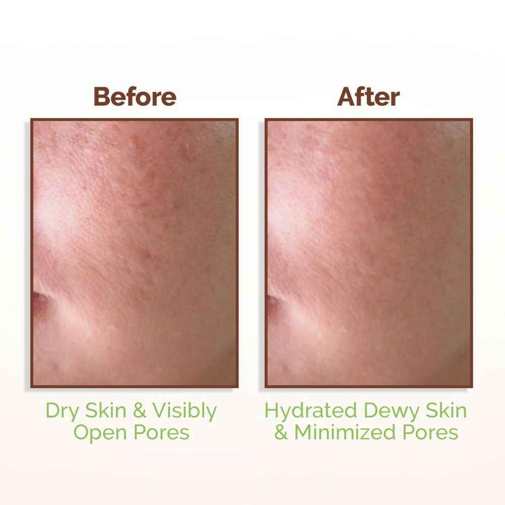 Mamaearth Rice Water Dewy Face Toner with 96% Pure Rice Water Extract &amp; 4% Niacinamide for Glass Skin