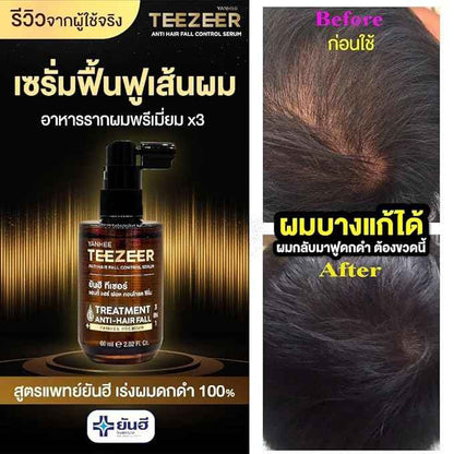 Yanhee Teezeer Anti Hair Fall Nourishes Hair Roots Control Serum 60 ml