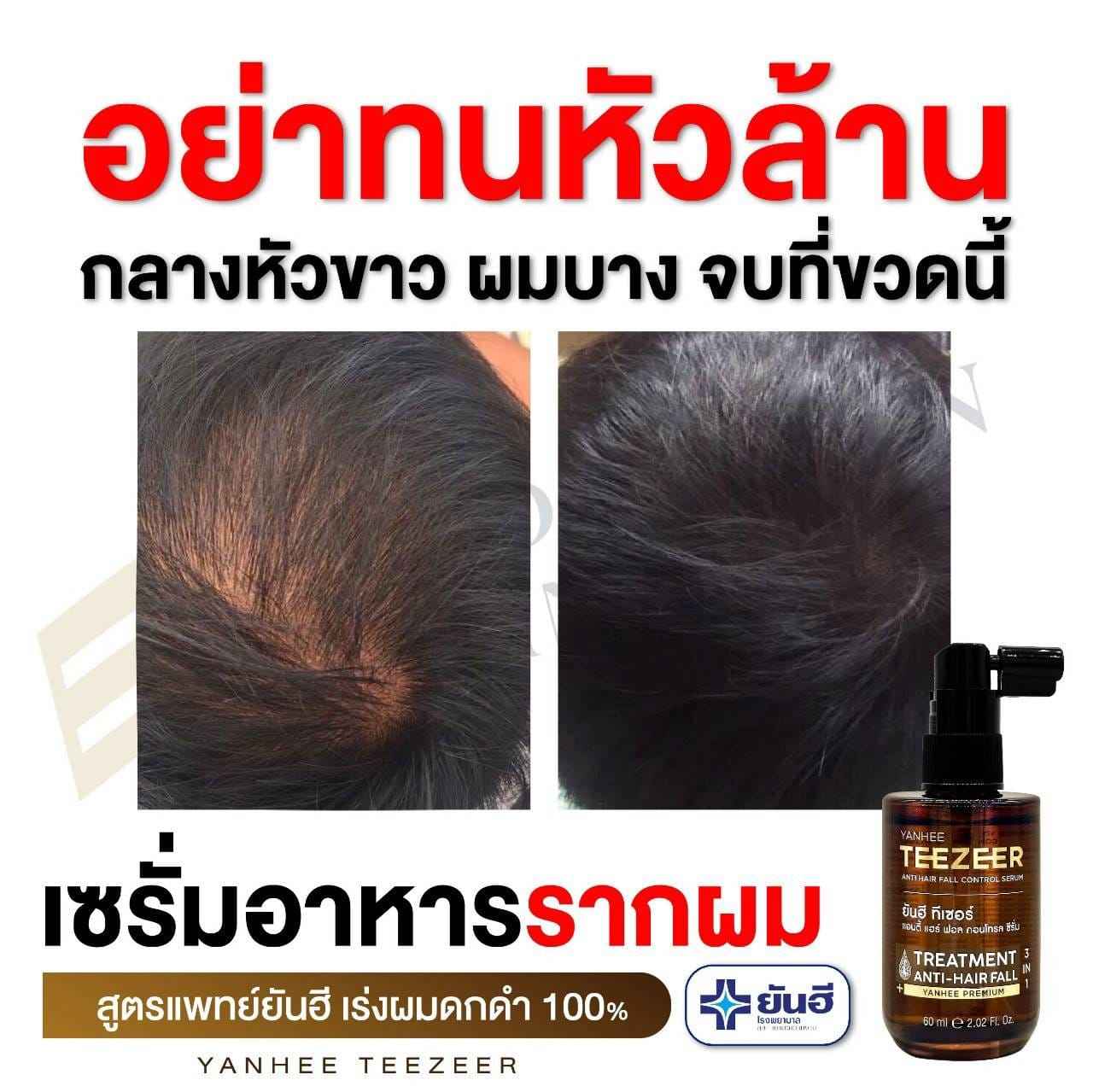 Yanhee Teezeer Anti Hair Fall Nourishes Hair Roots Control Serum 60 ml