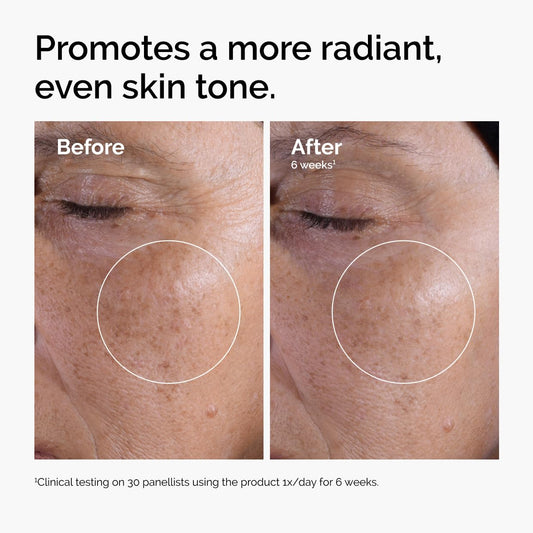 The Ordinary Glycolic Acid 7% Toner - Exfoliating & Brightening Daily Toner for Even Skin Tone - DestGlow