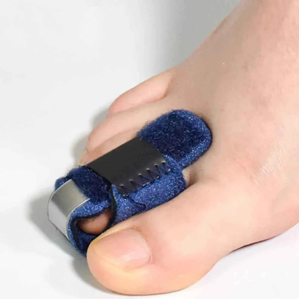 HammerToeFix™ Toe Splint Straightener – Hammer Toe Relief &amp; Alignment