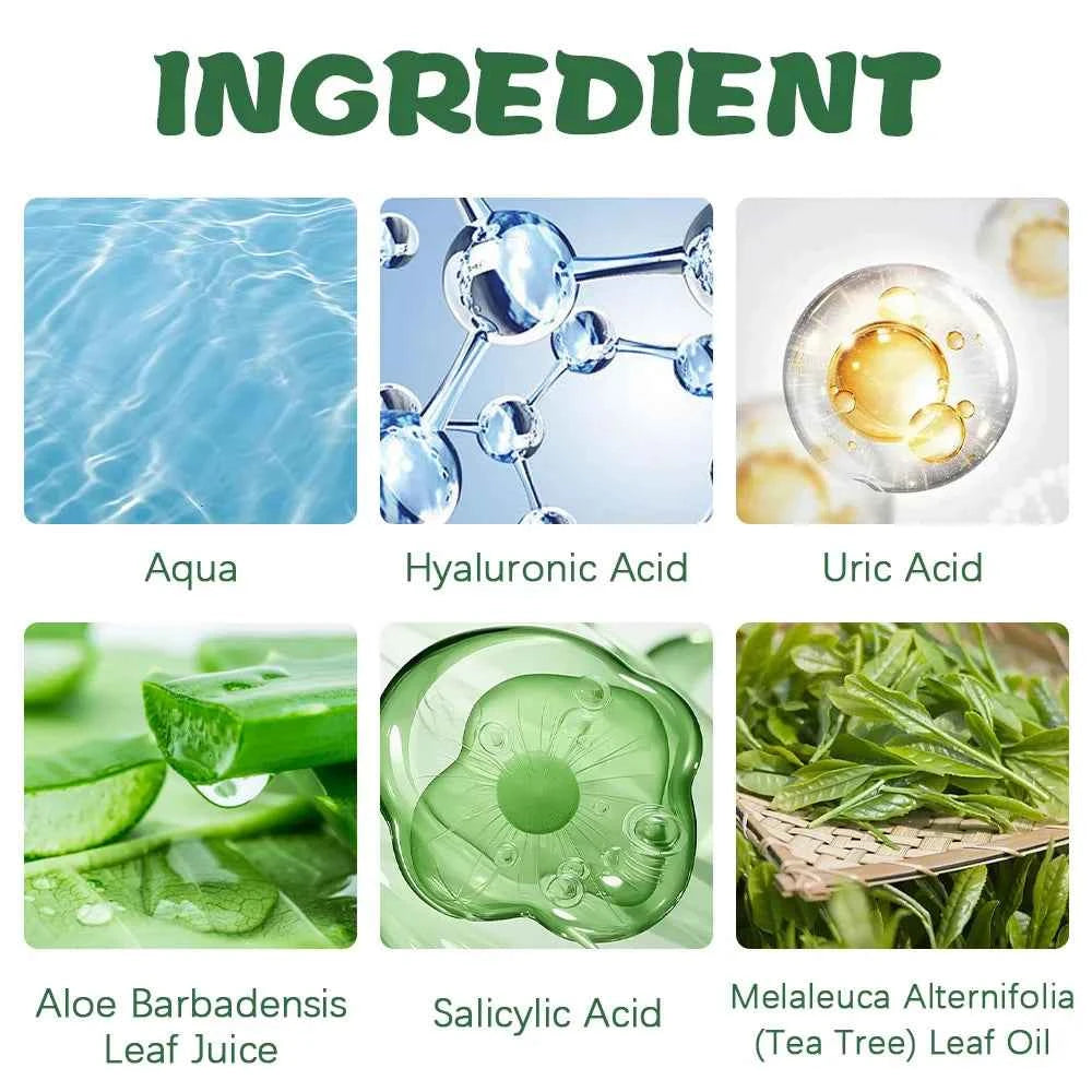 Urea Cream for Cracked Heels with 42% Urea