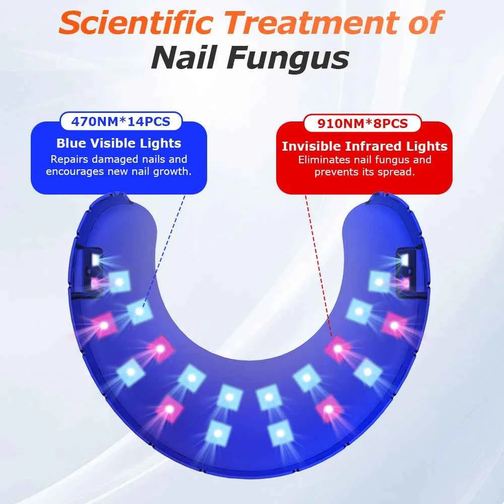 FungiClear™ Wireless Nail Fungus Laser – Foot Care &amp; Nail Health